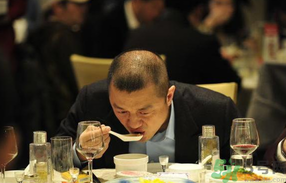男人禿頂會遺傳嗎？男人禿頂是腎虛嗎？
