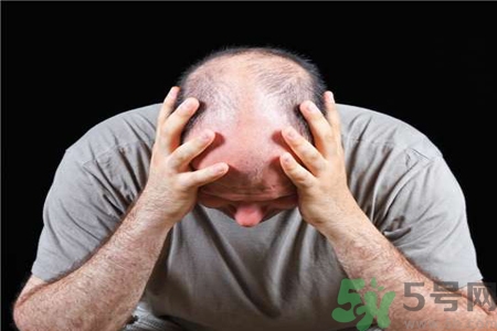 脫發(fā)的治療方法是什么？脫發(fā)的藥物治療有哪些？