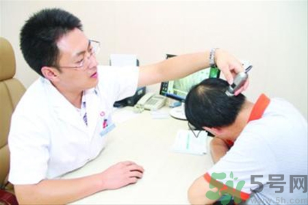 脫發(fā)會遺傳嗎？脫發(fā)遺傳可以治療嗎？