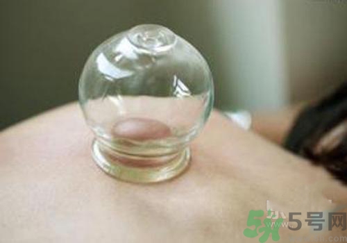 拔火罐和拔氣罐哪個好？拔火罐和拔氣罐的區(qū)別