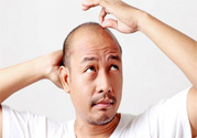脫發(fā)的高發(fā)人群有哪些？如何預防脫發(fā)？