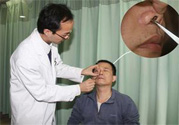 鼻咽癌的發(fā)病因素是什么？鼻咽癌的并發(fā)癥有哪些？