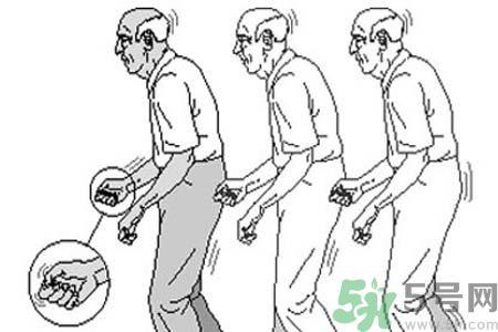 帕金森要注意哪些措施？帕金森的飲食需注意什么？