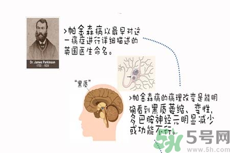 帕金森的治療方法有哪些？