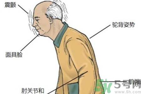 帕金森的易發(fā)人群有哪些？如何預(yù)防帕金森？