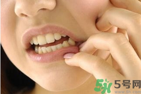 天熱牙疼要注意什么？天熱牙疼什么原因？