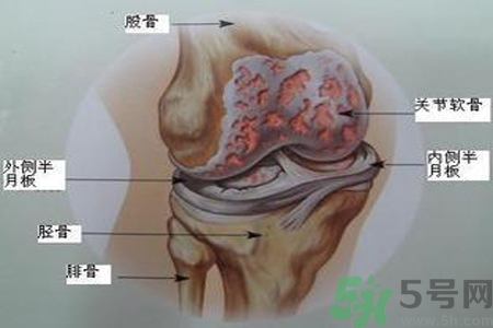 預防骨病需要注意哪些姿勢？秋季預防骨病的方法有哪些？