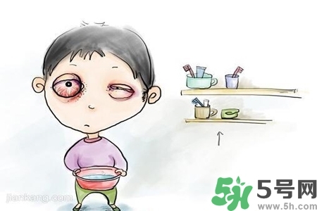 寶寶為什么會感染紅眼病？寶寶患紅眼病如何治療？