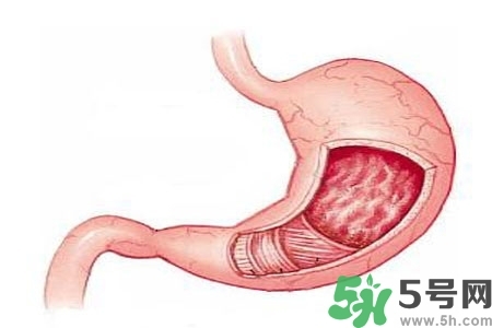 急性腸胃炎哪些食物不可以吃？急性腸胃炎不能吃的水果有？