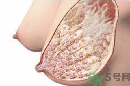 乳腺增生可以懷孕嗎？如何預防乳腺增生？
