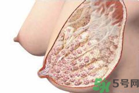 乳腺增生治療方法是什么？乳腺增生的檢查方法有哪些？