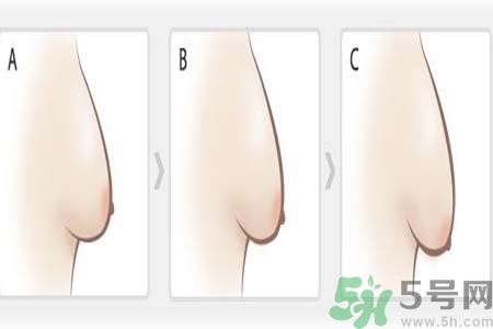 胸部松弛的原因是什么？胸部松弛該怎么辦？