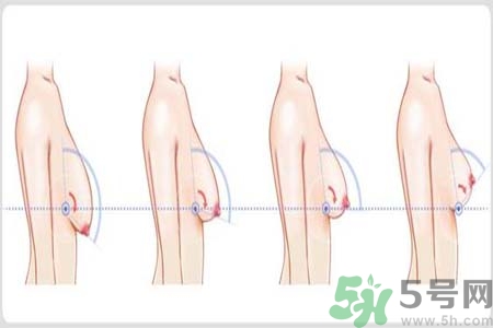 胸部松弛的原因是什么？胸部松弛該怎么辦？