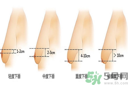 胸部松弛的原因是什么？胸部松弛該怎么辦？
