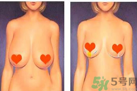 如何預(yù)防胸部松弛？吃什么能使胸部挺拔？