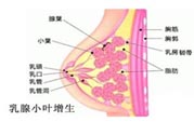 乳腺增生治療方法是什么？乳腺增生的檢查方法有哪些？