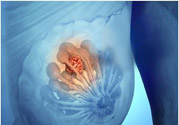 乳房有硬塊正常嗎？乳房有腫塊怎么回事？