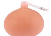 乳頭內(nèi)陷可以拔罐嗎？乳頭內(nèi)陷需要手術(shù)治療嗎？