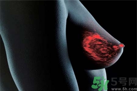 乳房上有硬塊怎么辦？乳房有硬塊的病因是什么？