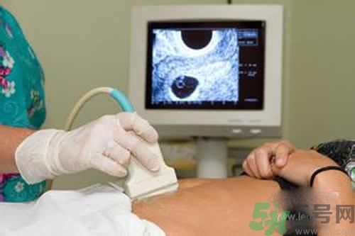 孕婦做b超要空腹嗎？孕婦做b超要不要空腹？