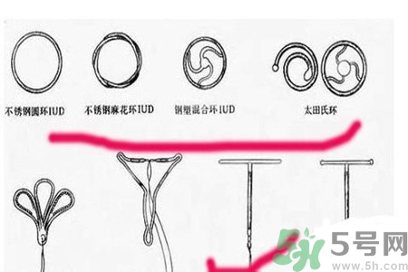 什么是宮內(nèi)節(jié)育器？放置宮內(nèi)節(jié)育器為什么能避孕？