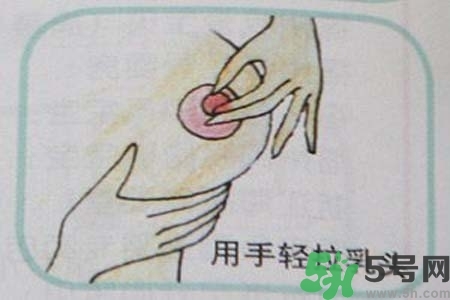 乳頭內(nèi)陷怎么矯正？乳頭內(nèi)陷矯正方法是什么？