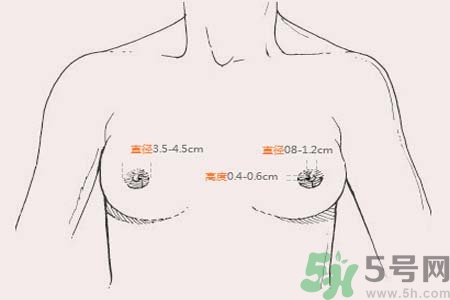 乳頭內(nèi)陷能不能喂奶？乳頭凹陷怎樣哺乳？