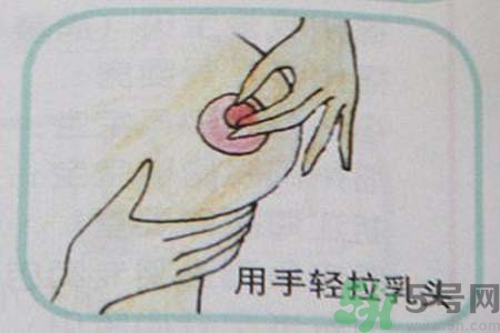 乳頭內(nèi)陷可以拔罐嗎？乳頭內(nèi)陷需要手術(shù)治療嗎？