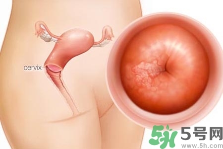陰道干澀是什么？陰道干澀的危害有什么？