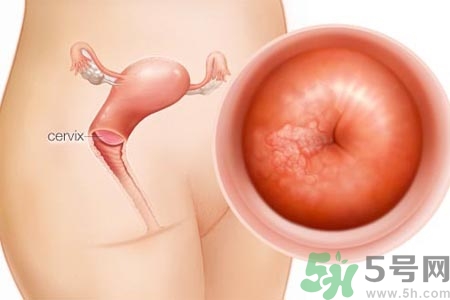 陰道干澀的原因是什么？陰道干澀怎么辦？