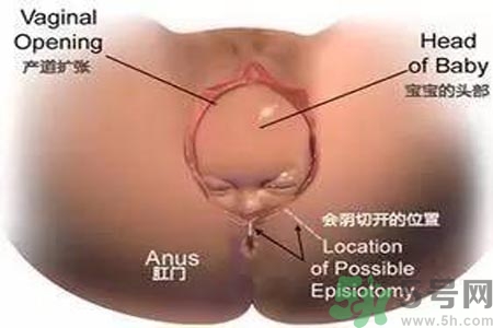 女性陰道松弛的原因是什么？女性陰道松弛怎么辦？