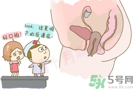 陰道松弛有什么危害？?陰道松弛恢復(fù)的方法有哪些？