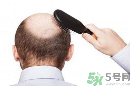 男性衰老的年齡段是什么？各年齡段男性抗衰老法則