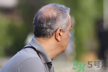 男性衰老的征兆有哪些？男性10個(gè)難以逆轉(zhuǎn)的衰老征兆
