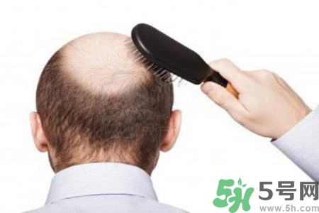 男性防止性衰老決竅有哪些？男性受用一生抵抗衰老法則