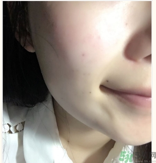 麗得姿面膜適合孕婦可以用嗎？麗得姿面膜哪些孕婦可以用？
