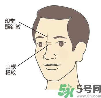 耳垂上有豎紋是怎么回事？山根有橫紋是什么病？