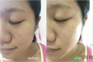rilastil面膜使用方法 維納斯蒂爾面膜怎么用？