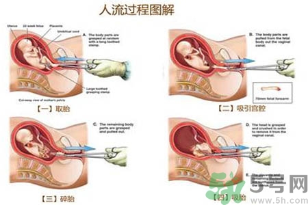 人流后怎么調(diào)養(yǎng)身體？人流后飲食需注意什么？