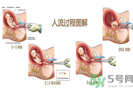人流后怎么調(diào)養(yǎng)身體？人流后飲食需注意什么？