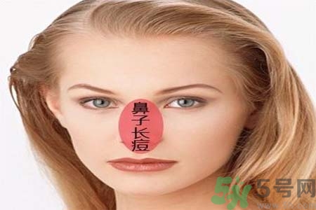鼻翼長(zhǎng)痘痘怎么回事？鼻翼長(zhǎng)痘痘的原因是什么？