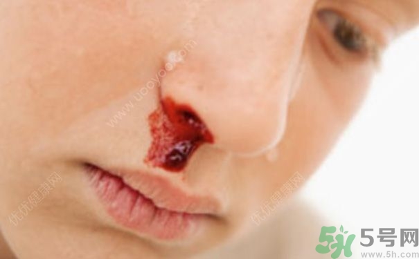 15歲男孩可以刮胡子嗎？15歲男孩經(jīng)常流鼻血怎么回事？