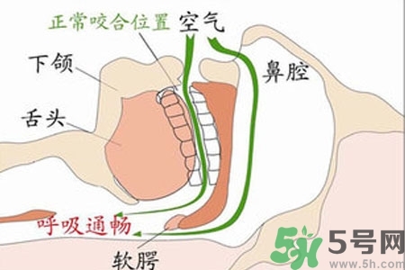鼻子紅是什么原因？鼻子紅怎么辦？
