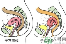 子宮移位的原因是什么？子宮移位的癥狀有哪些？