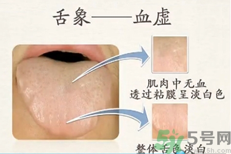 血虛怎么調(diào)理？女人血虛怎么調(diào)理？