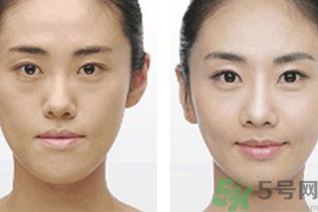 激光縮毛孔多少錢一次？激光縮毛孔一個療程多少錢？