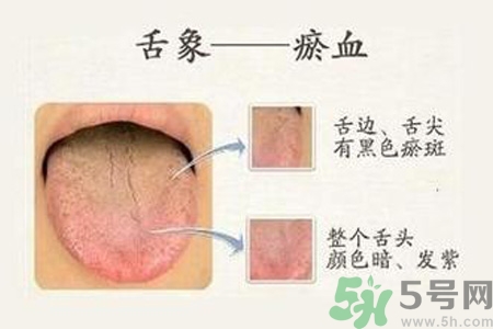 血瘀體質(zhì)吃什么？血瘀體質(zhì)怎么調(diào)理？