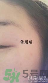 dr.jart適合什么年齡層？蒂佳婷適合年齡