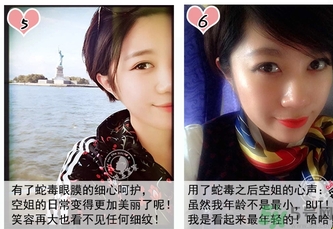 蛇毒眼膜孕婦可以用嗎？ 日本spa蛇毒眼膜孕婦能用嗎？