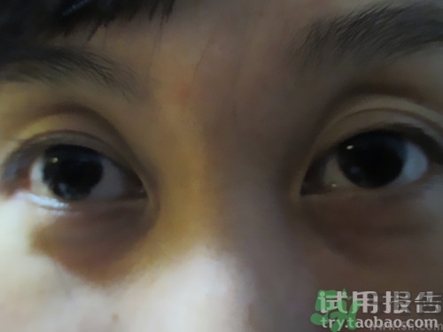 蛇毒眼膜效果怎么樣？spa蛇毒眼膜紅色好用嗎？